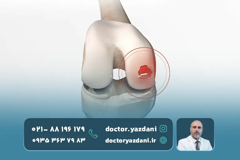 ترمیم-آسیب_های-غضروفی 